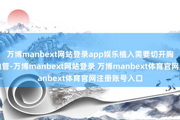 万博manbext网站登录app娱乐植入需要切开胸腔或者穿刺血管-万博manbext网站登录 万博manbext体育官网注册账号入口